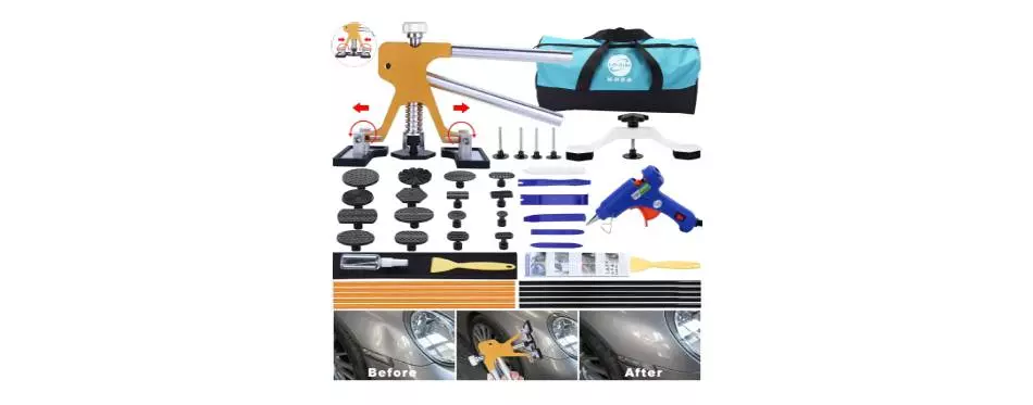 Gliston Paintless Dent Repair Tool Dent Puller Kit